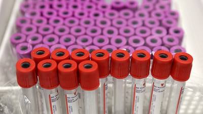 Study: Blood test spots multiple cancers even in those without clear symptoms