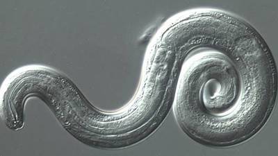 Scientists warn that parasitic brain worm is being seen in the Southeast US